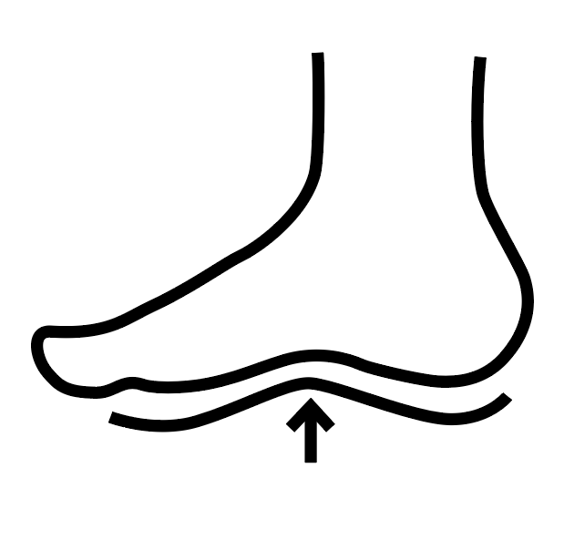 Flat Feet